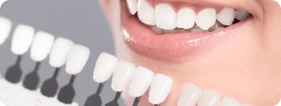 1-Hour Teeth Whitening