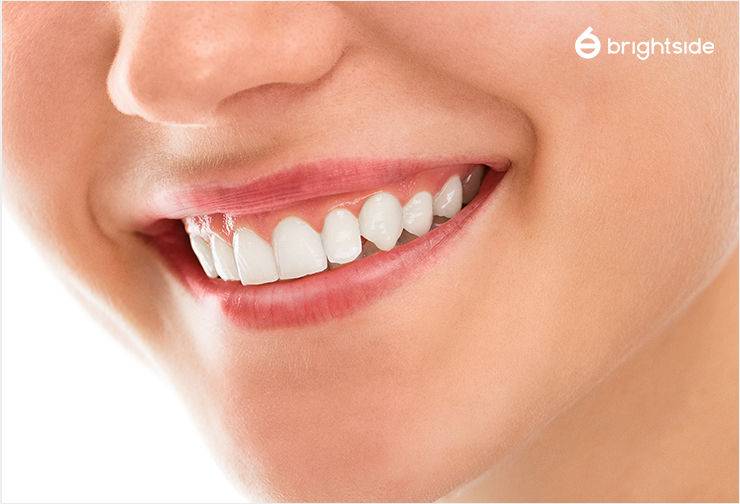 Image of a smile showing neat and white teeth