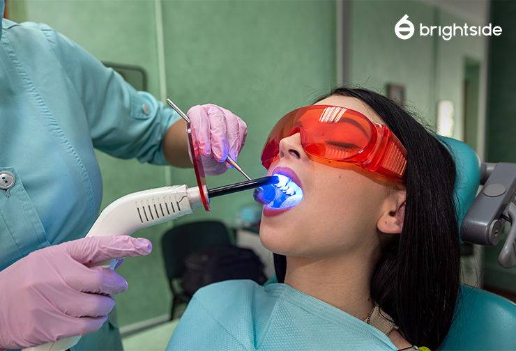 Teeth Whitening at a Dental Clinic vs Beauty Salon