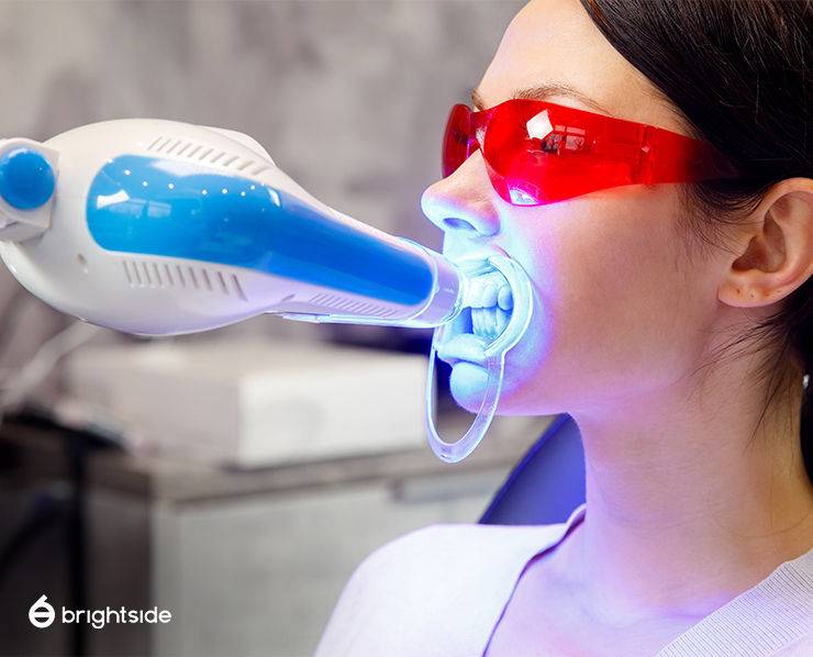 Teeth Whitening Professional Whitening or DIY? Brightside Dental