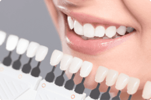 Woman comparing tooth color shades for whitening.