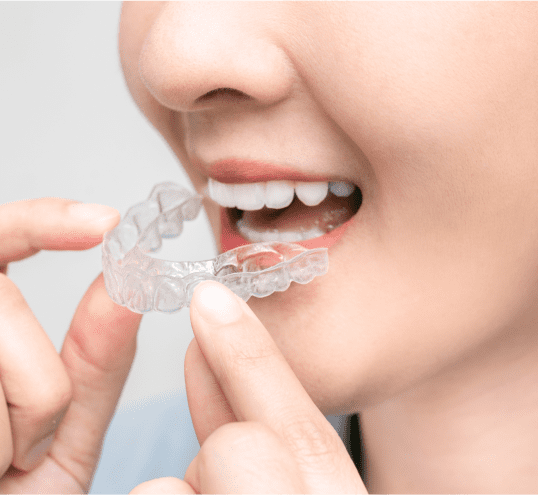 Figure smiling while putting clear aligner on