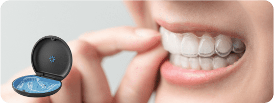 Smile with clear aligners on with an product image of clear aligners in the case
