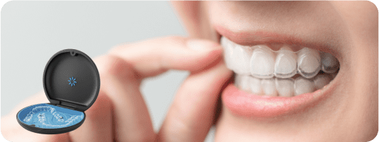 Clear Aligners