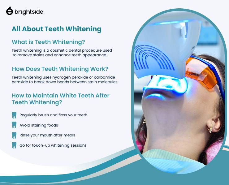 Infographic of all about teeth whitening