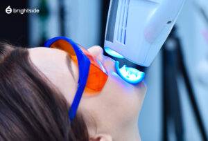 Person receiving teeth whitening treatment