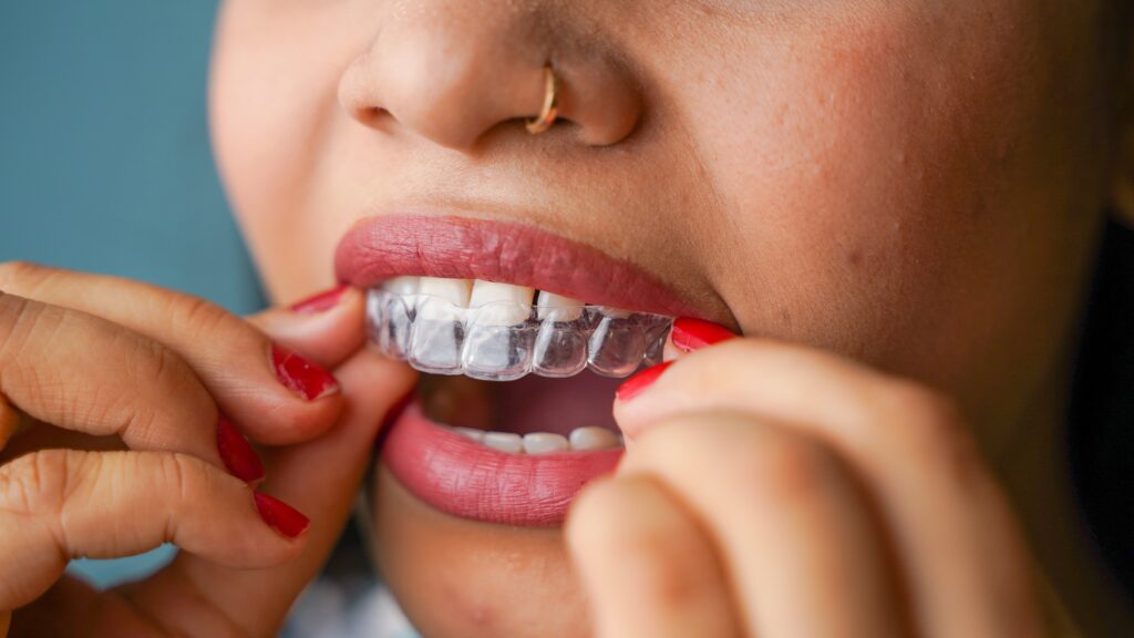 young,asian,indian,woman,holding,removable,invisible,aligner,,also,known