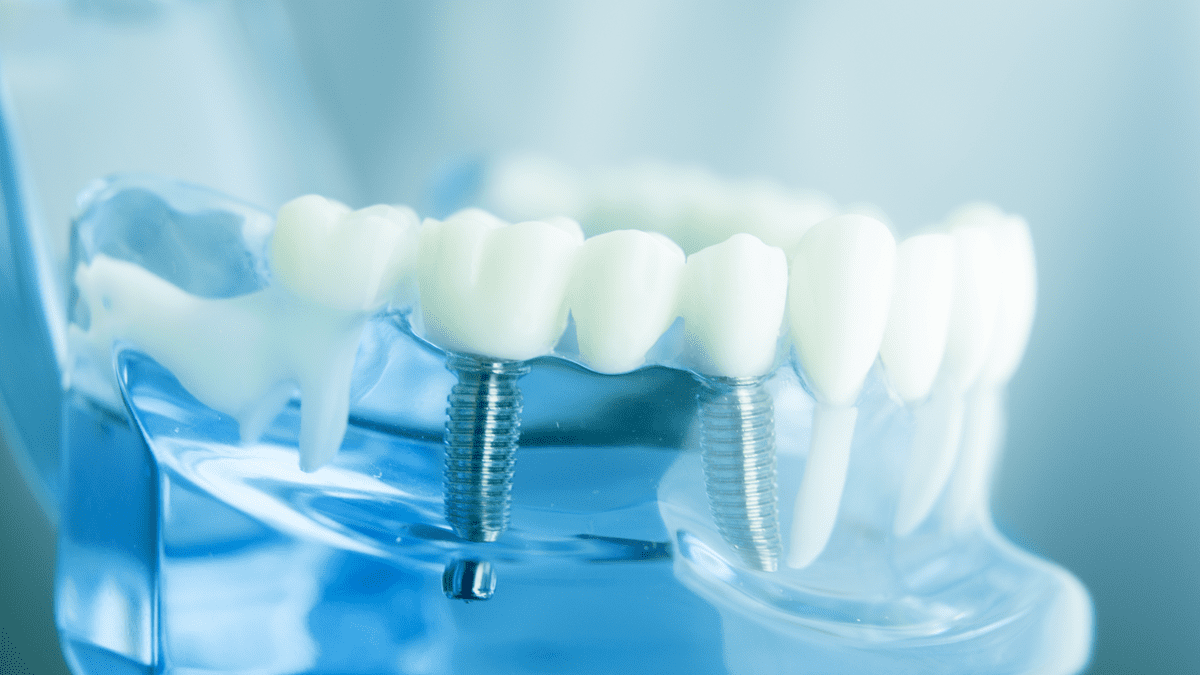 medical device dental implants stock