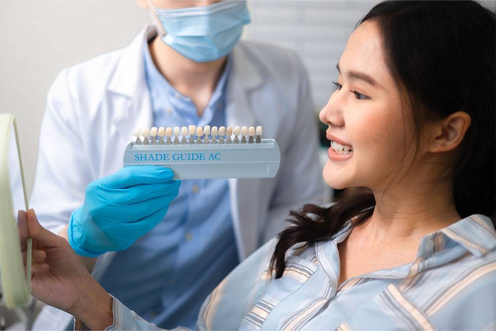 dentist checking veneers shade guide
