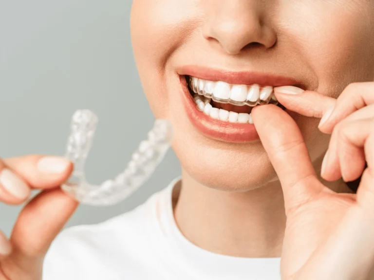 Woman smiling with clear aligners on her teeth while holding out a clear aligner