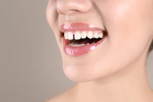Patient with diastema