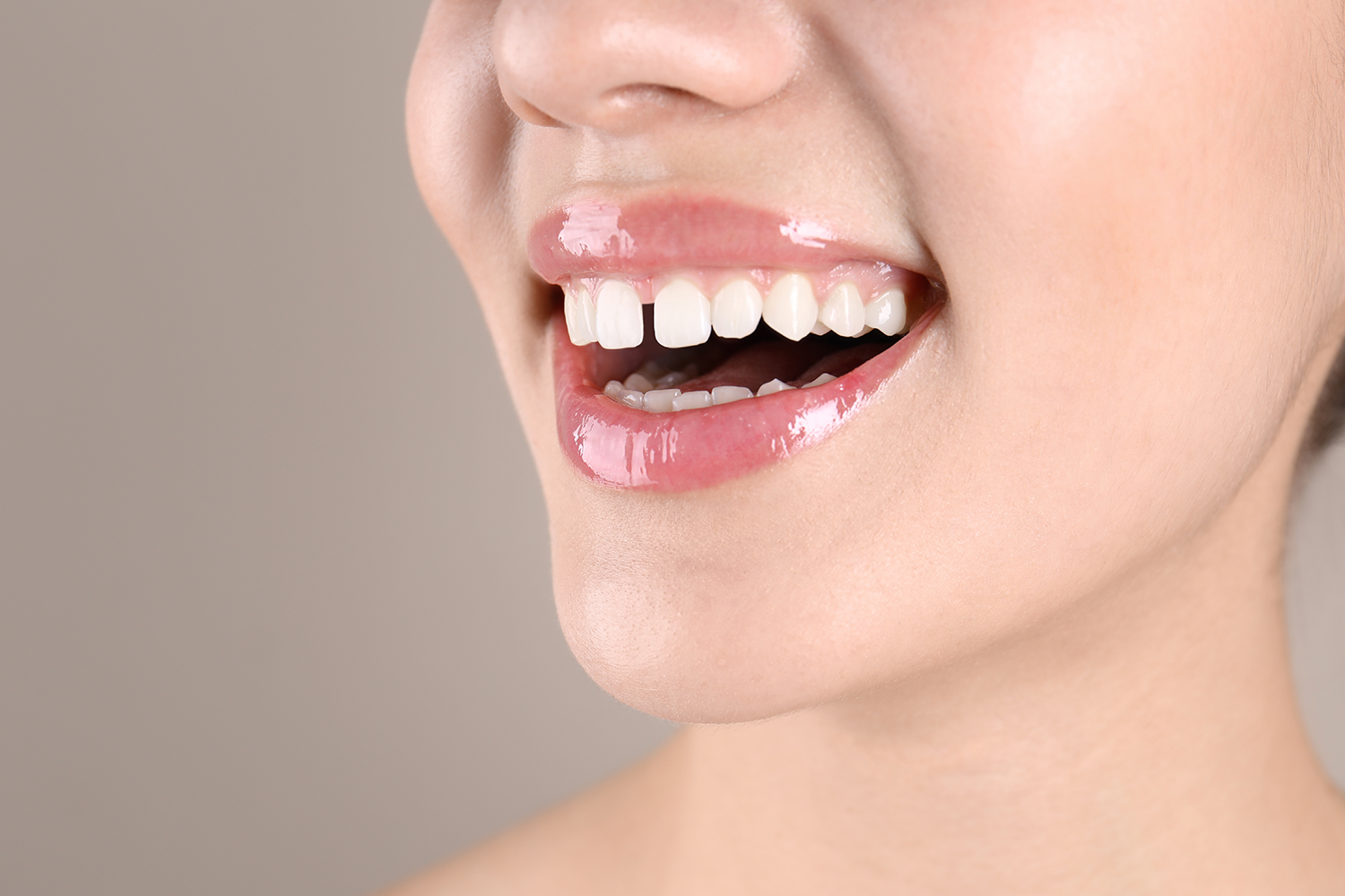 Patient with diastema